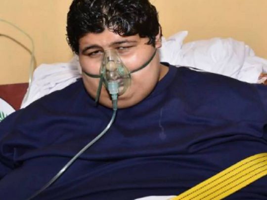 Колишня «найтовстіша людина у світі» показала, як виглядає через вісім років — перетворення вразило користувачів мережі