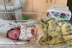 В Одессе медики спасли двух младенцев, которые весили менее 900 грамм 