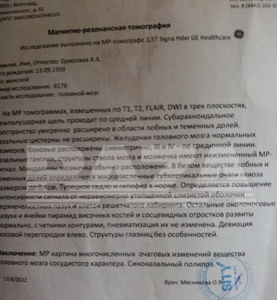 Забирають навіть з діабетом та ішемією мозку: у росії почали «мобілізувати» людей з цілими «букетами» захворювань