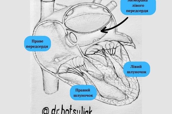 В Одессе прооперировали ребенка с трехпредсердным сердцем