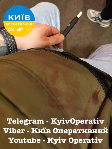 Вбивство у київському фунікулері: загинув 16-річний юнак